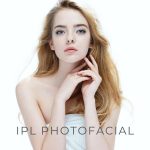 Photofacial Treatment